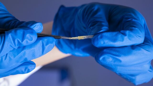 hydrogel skin replacement stretched