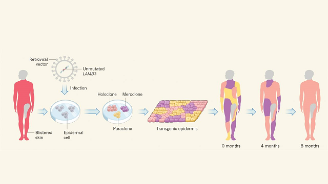 ‘Artificial’ Skin Breakthrough