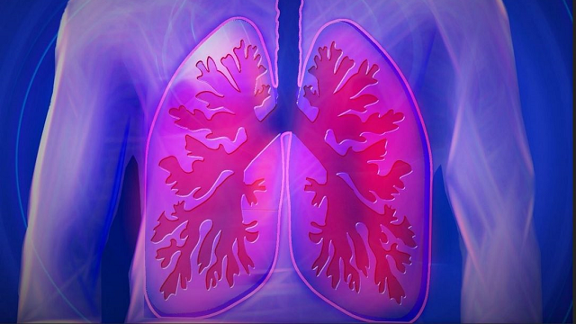 Clues to earlier diagnosis of deadly lung disease