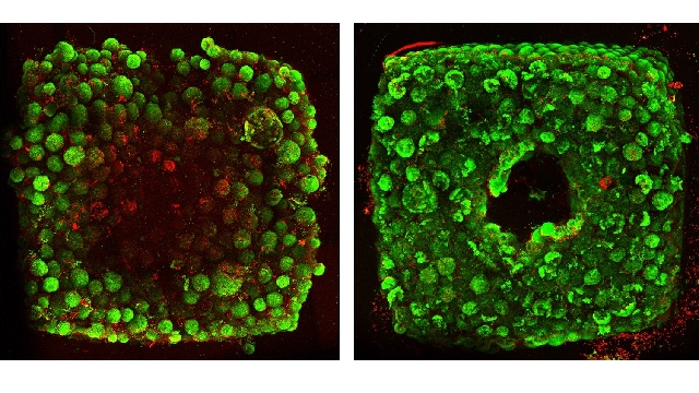 A new approach to 3D printing human organs