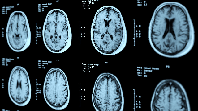 A simple gel could help prevent radiation burns
